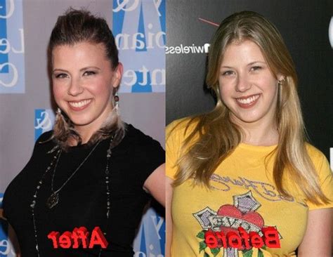 Jodie Sweetin Admits Breast Job